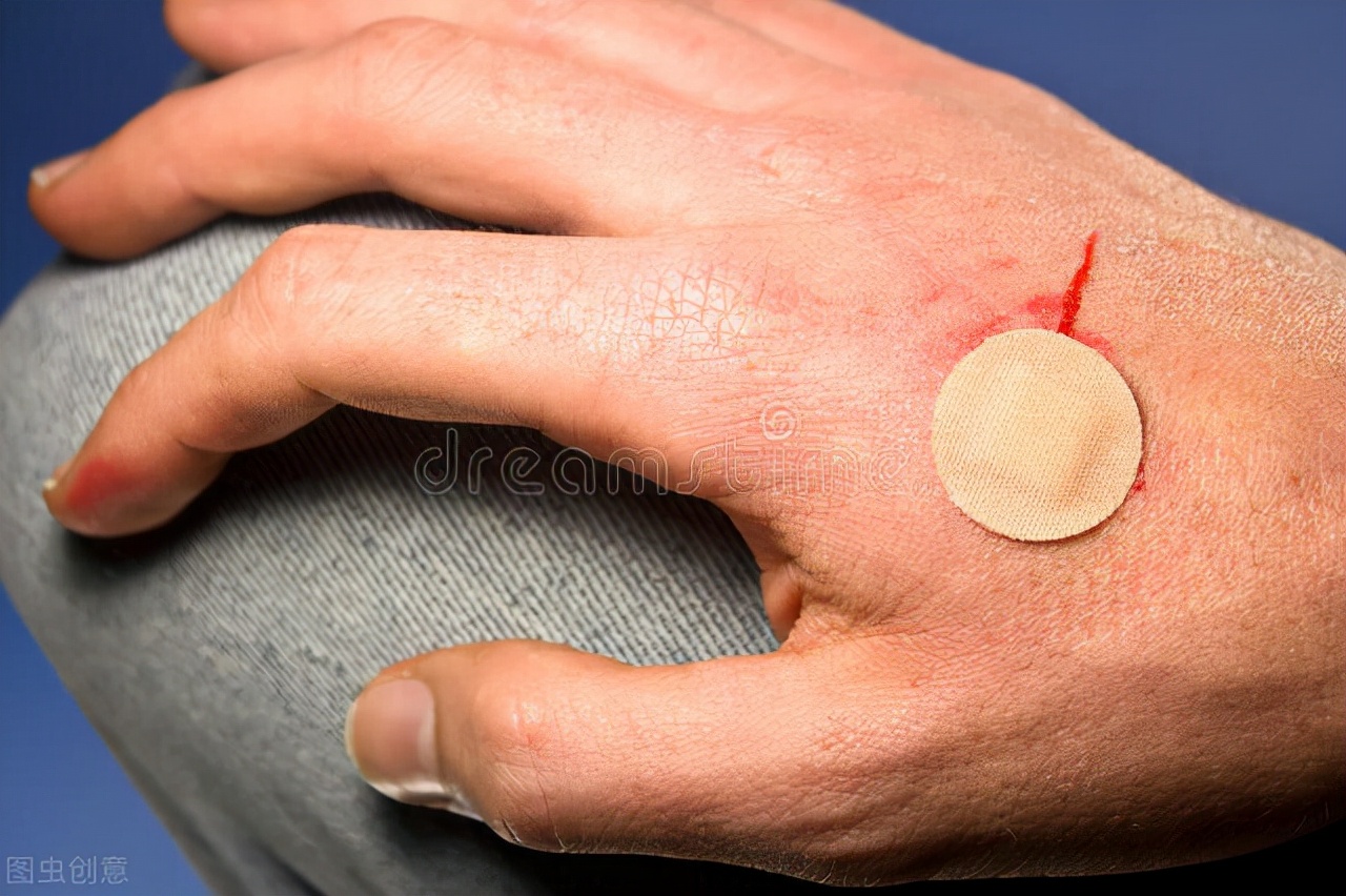 外伤止血包扎的操作流程视频,外伤出血如何清创包扎