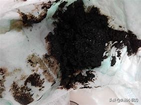 心好方，便便里面全是血，不想去医院，是不是癌啊，我该咋办？