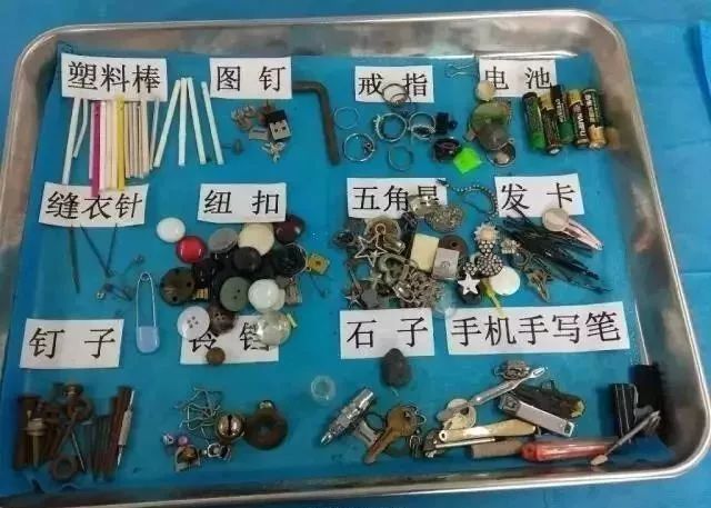 幼儿误吞磁力珠致小肠穿孔,女孩误吞磁力珠致6处肠穿孔