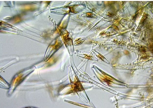 硅藻水,硅藻水和绿藻水区别