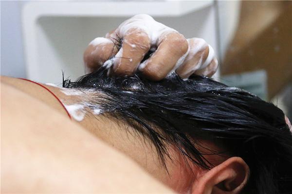 头皮发痒一抓就掉头发怎么回事,头皮痒一抓就起包咋回事