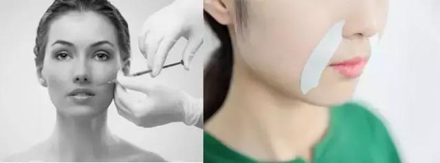 硬刚女皇龙妈也扛不住法令纹,2条沟壑让人心疼,贴一贴就消了