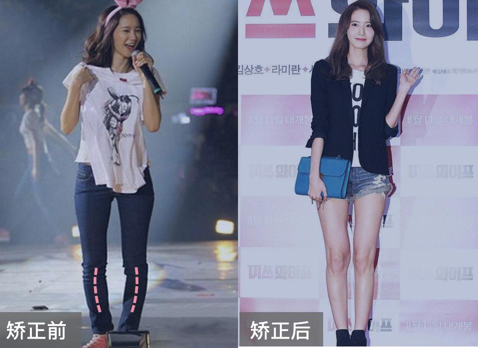 女明星腿精大赏：o型腿也能变成腿精