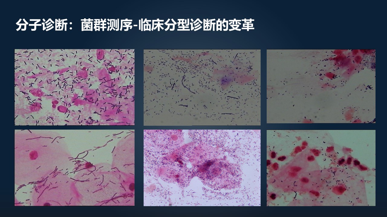 肖冰冰,肖冰冰的创作