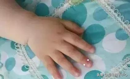 小儿推拿便秘咳嗽,小儿推拿积食通便