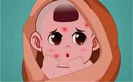 血管瘤破了可以擦碘伏吗,嘴唇血管瘤破溃结痂能不能恢复