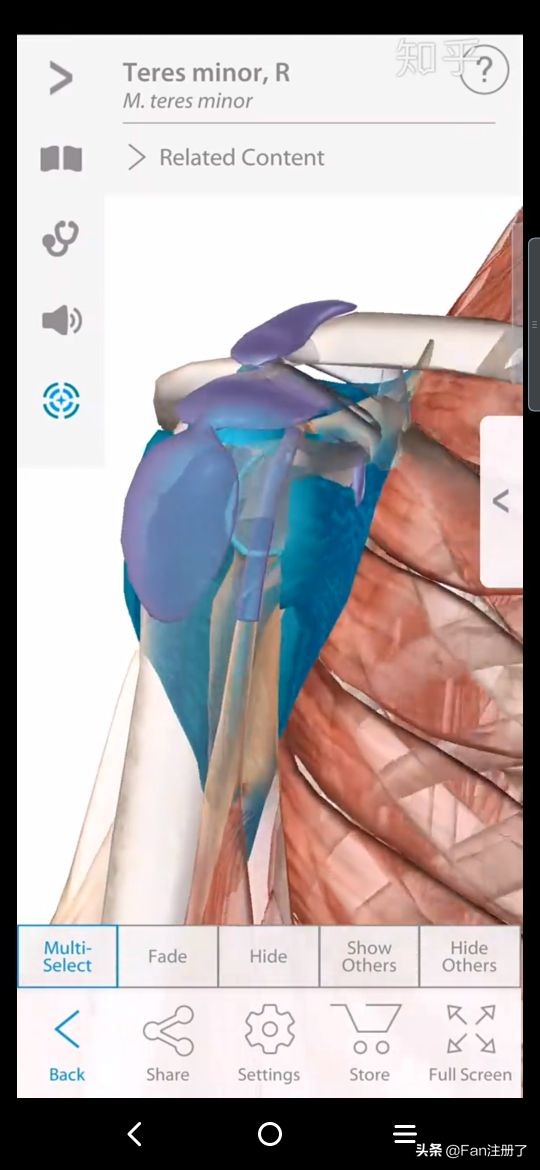 肩痛肩袖损伤针刀治疗,肩痛肩关节活动受限用什么药