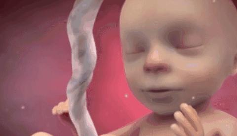 脐带脱落胎儿命悬一线,婴儿出生十天脐带未脱落且有血