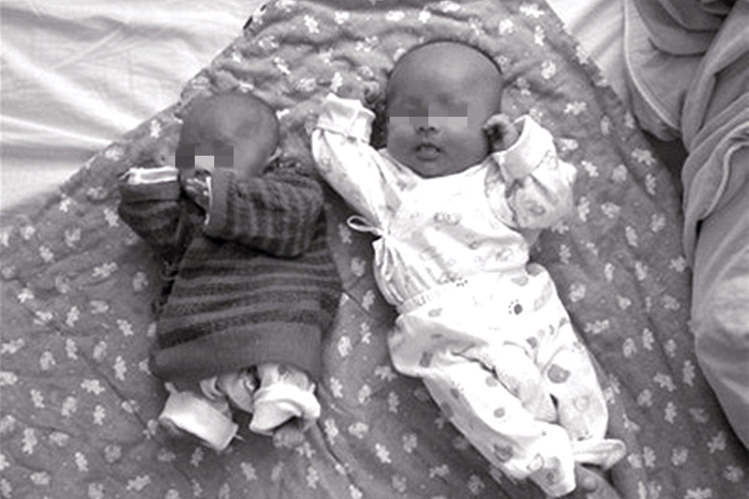 双胞胎刚出生体重相差2斤正常吗,双胞胎宫内体重相差多少受限