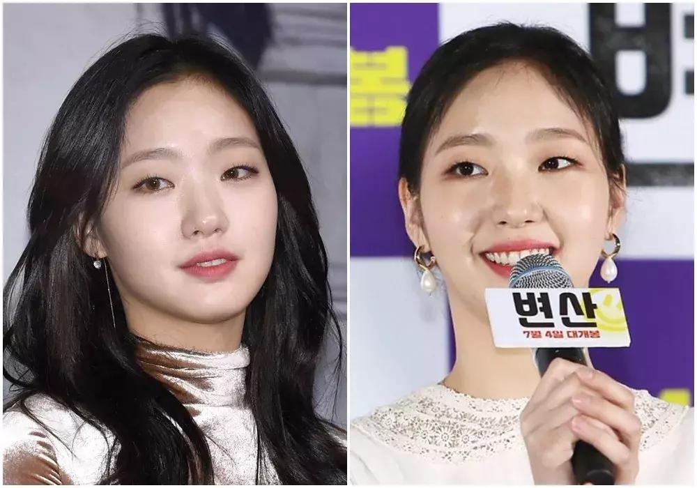 冬天脸肿眼浮肿是什么原因,冬天为啥脸眼皮肿