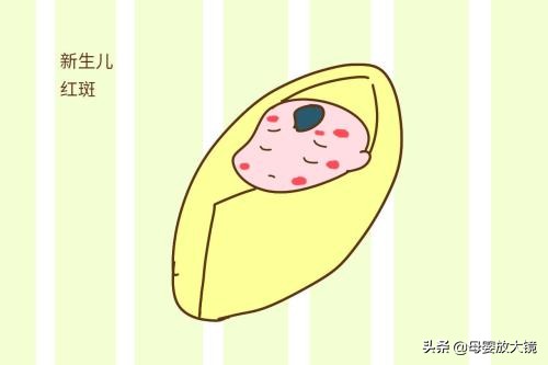 新生婴儿如何避免先天性疾病,天使宝宝的症状有哪些