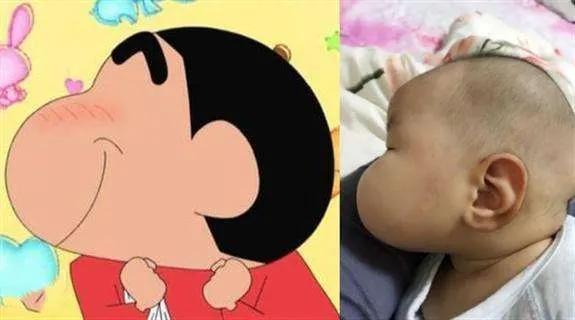 产妇胀奶要不要吸出来,产后涨奶宝宝怎样吸不痛