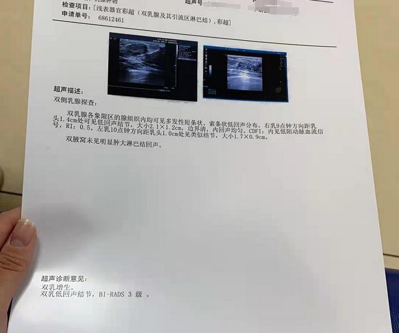 哺乳期乳房内长了一片小疙瘩,喂奶发现乳房有一个滚动的疙瘩