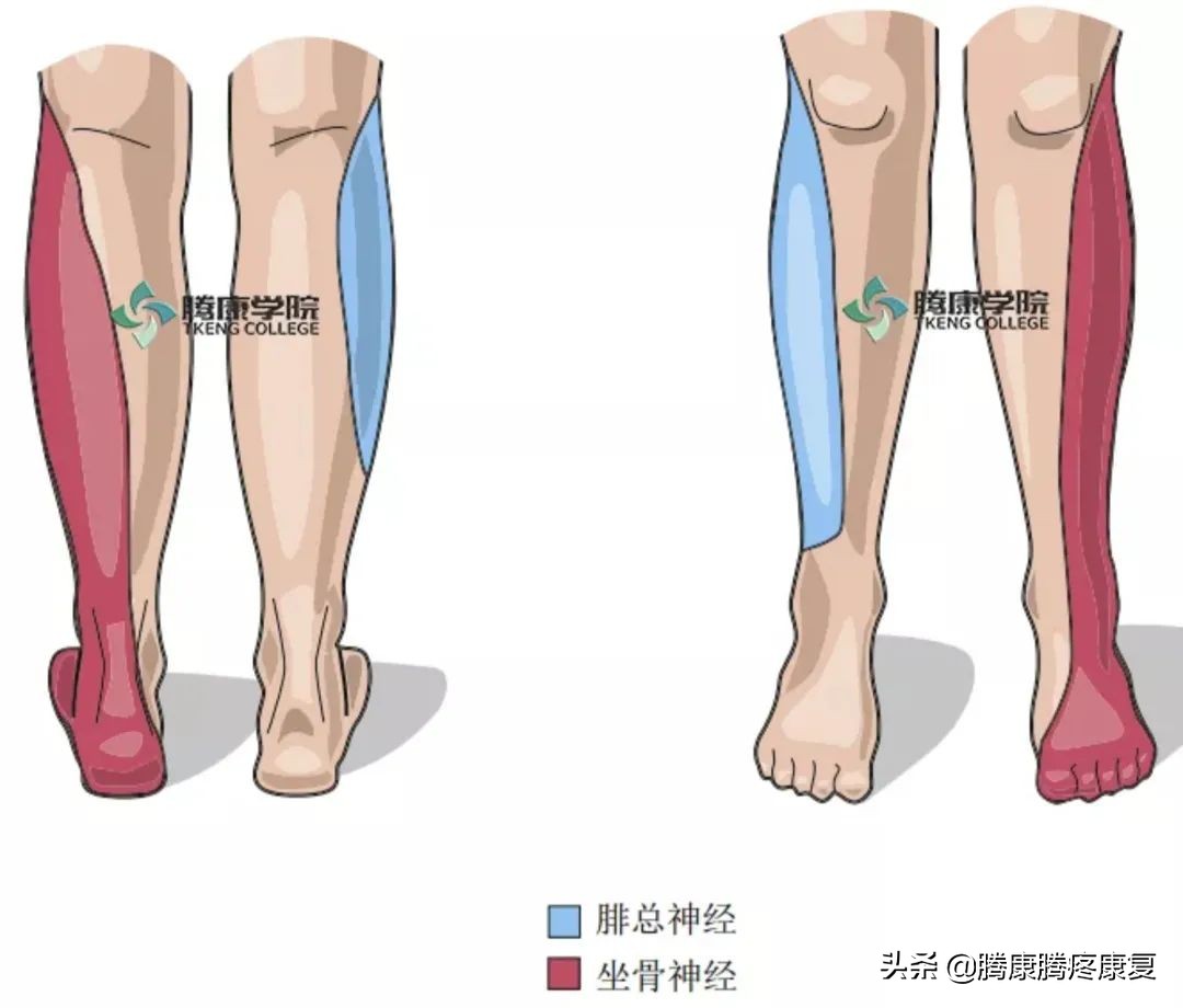 下肢常见神经损伤后表现