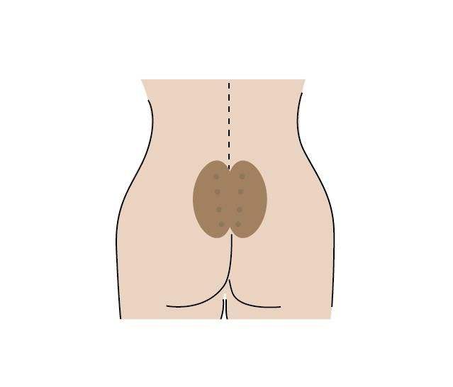 八髎穴让你的身体暖起来