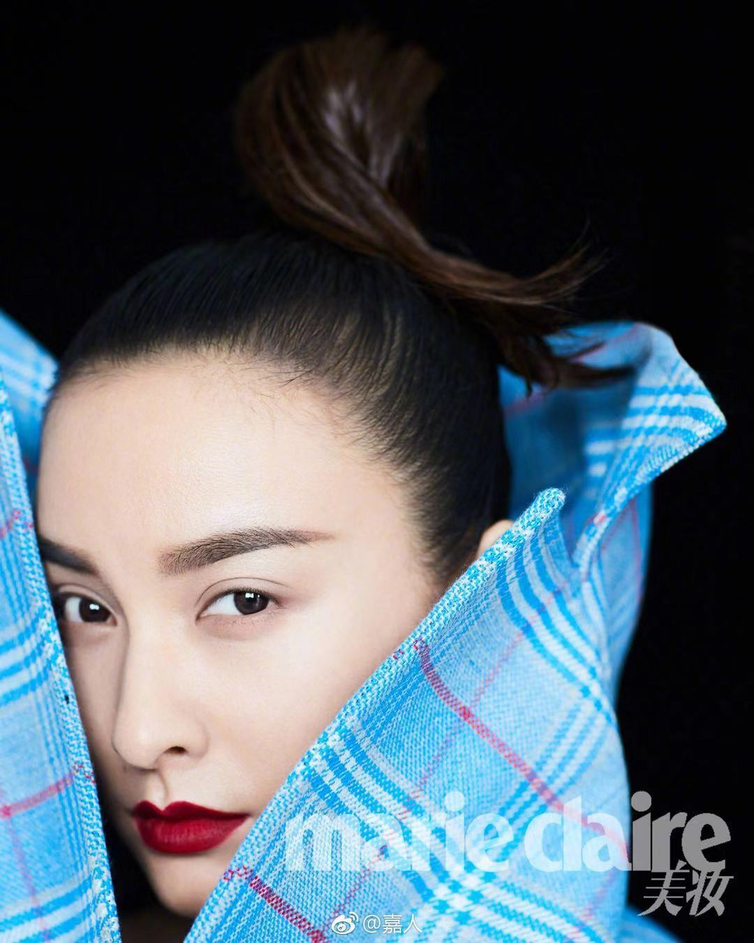 女生为啥发际线秃了,30岁发际线变秃