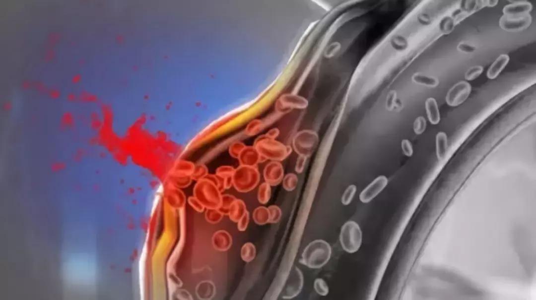 突发胸背疼20分钟后好了,半夜胸背痛是什么病的先兆
