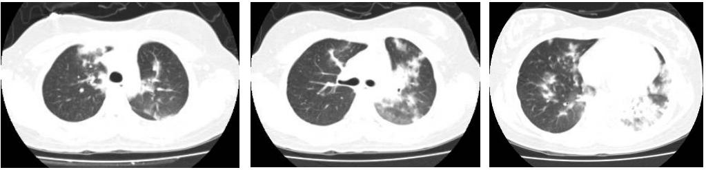 呼吸科陈荣昌,陈荣昌医学专家