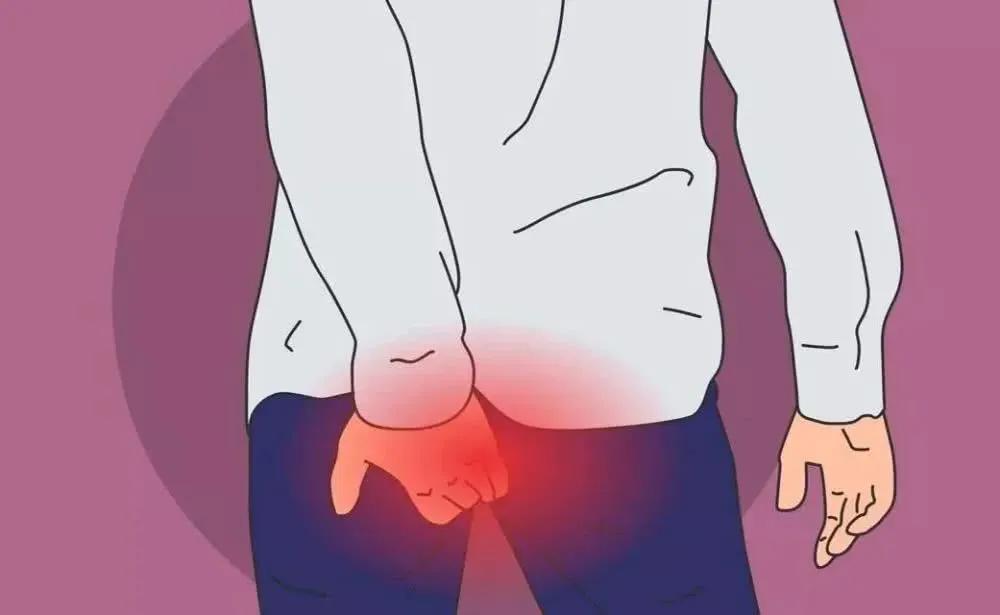 疫情期间常见肛肠疾病处理专家建议