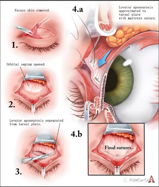 医学解剖创意绘画及作品简介,解剖手骨绘图大赛手绘图