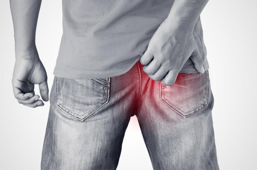 肛门疼肿就是痔疮？痔疮：这个黑锅我不背