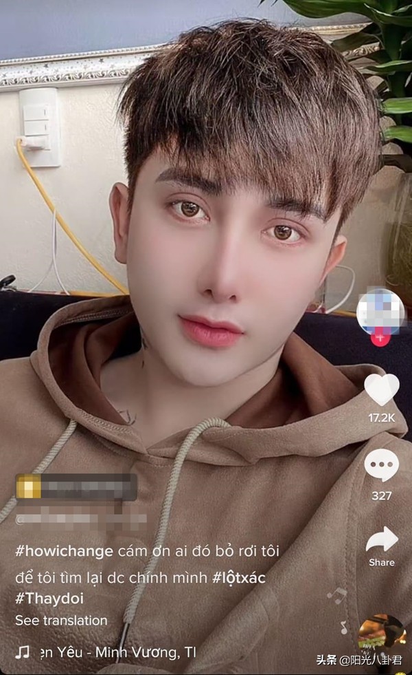 丑男整容变帅哥前后对比,丑男整容变帅哥对比照