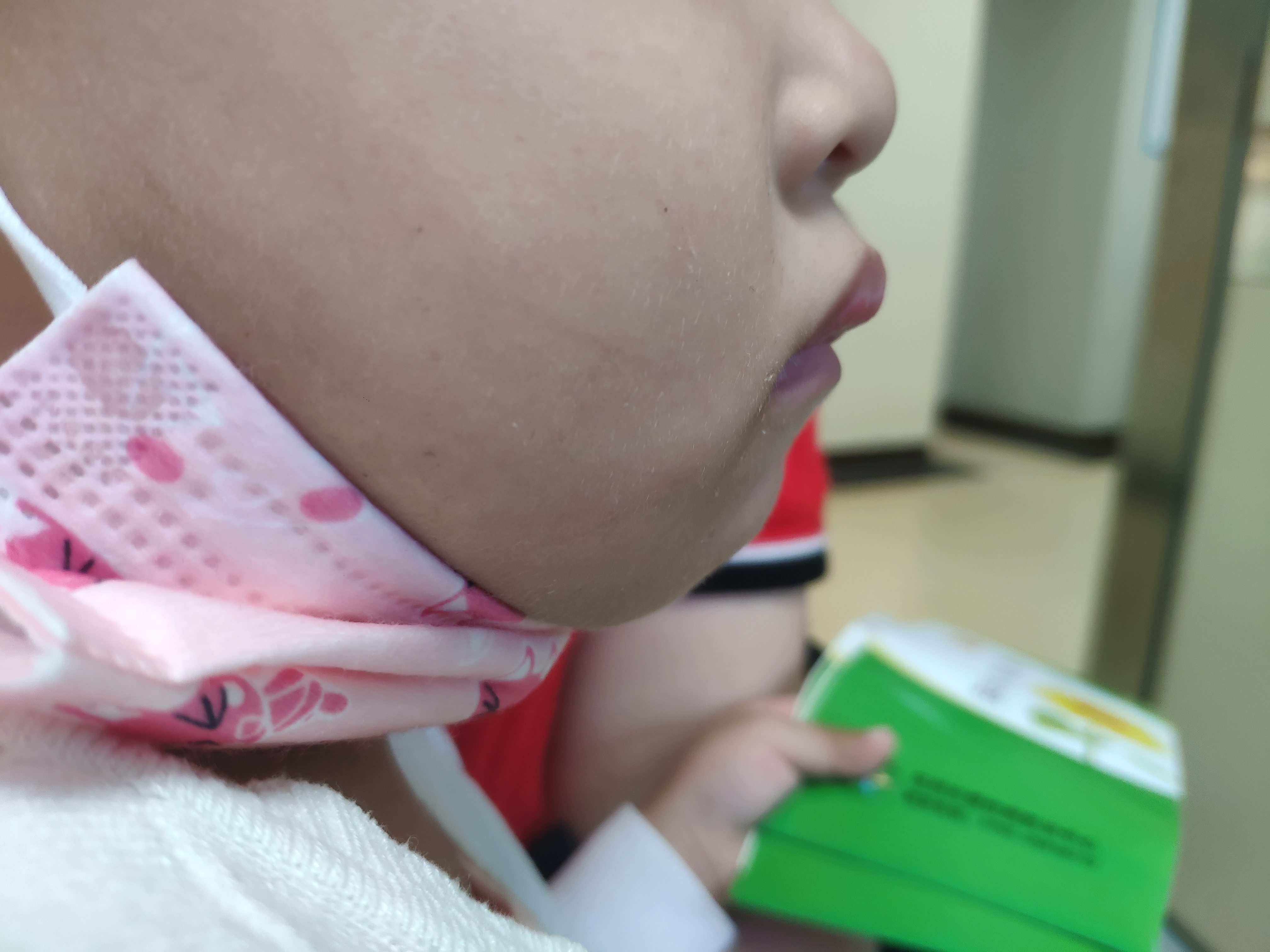 4岁儿子脾气暴躁，安静不了，是腺样体肥大还是多动症，要手术吗