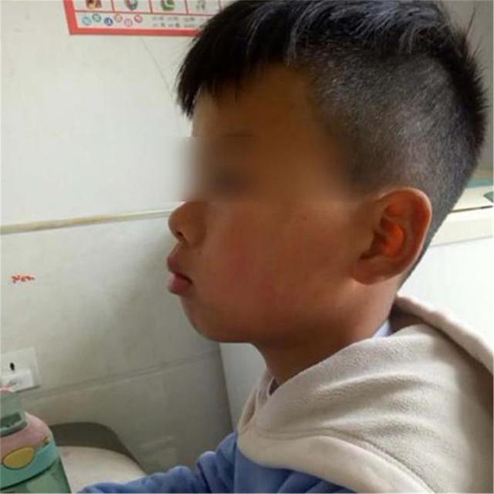 儿子越长越像大猩猩,长得像大猩猩的脸型