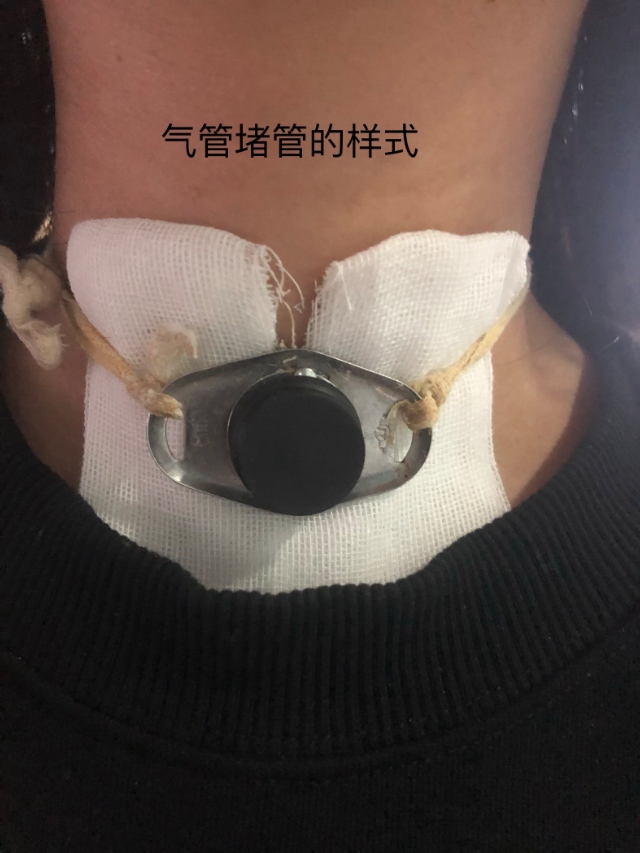 喉癌应了解哪些病史,癌症患者家属必须知道的这5个点