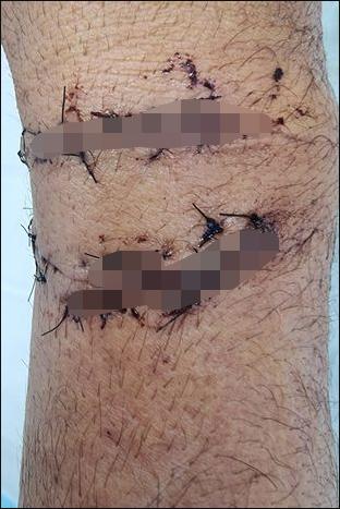 澳洲男子帮蛇过马路,被蟒蛇袭击该如何自救