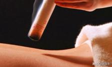 艾灸专家讲艾灸疗效,在家艾灸哪种灸法效果最好