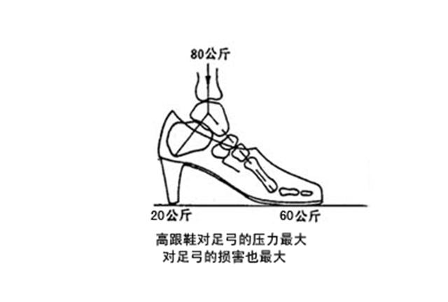 穿哪种鞋子更容易得扁平足,扁平足穿鞋难看怎么办