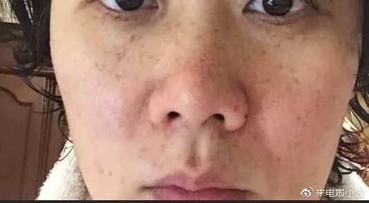 怀孕要换孕妇专用护肤品吗,孕妇怀孕期间用哪种护肤品比较好