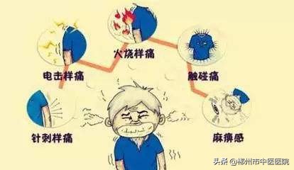 带状疱疹的诊断和治疗试题及答案,有问必答中医治疗带状疱疹的方法