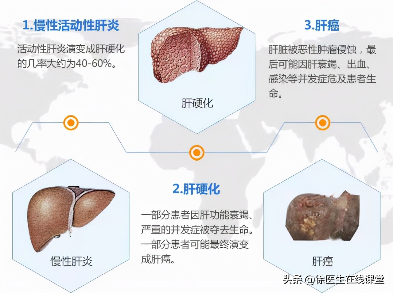 谷草转氨酶和谷丙转氨酶高会怎样,谷草转氨酶500谷丙转氨酶1800