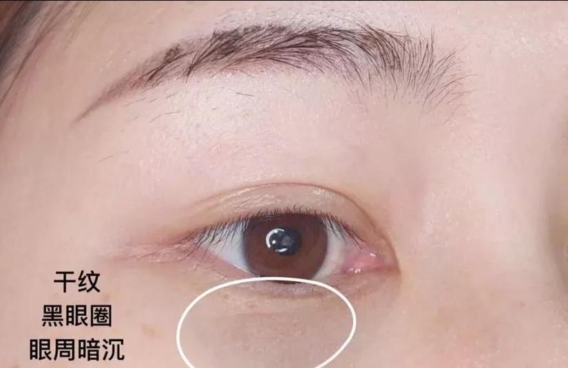 雅诗兰黛和兰蔻小黑瓶眼霜哪款好,兰蔻小黑瓶和雅诗兰黛眼霜哪个好