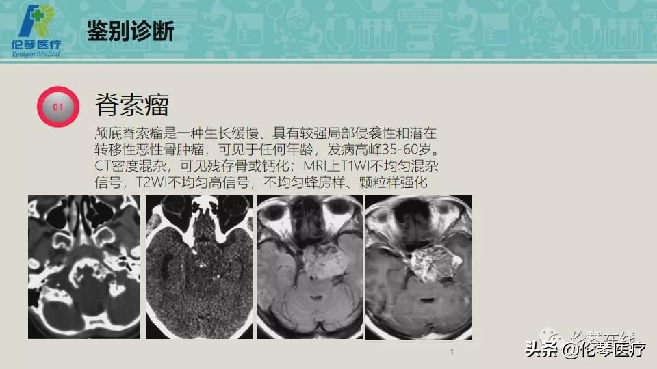 上海教授詹松华,上海曙光医院詹松华简介