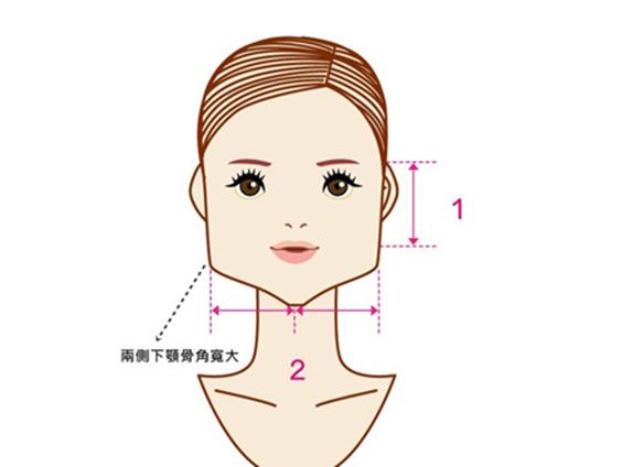 30岁下颌缘提升还有用吗,30岁下巴后缩能矫正吗