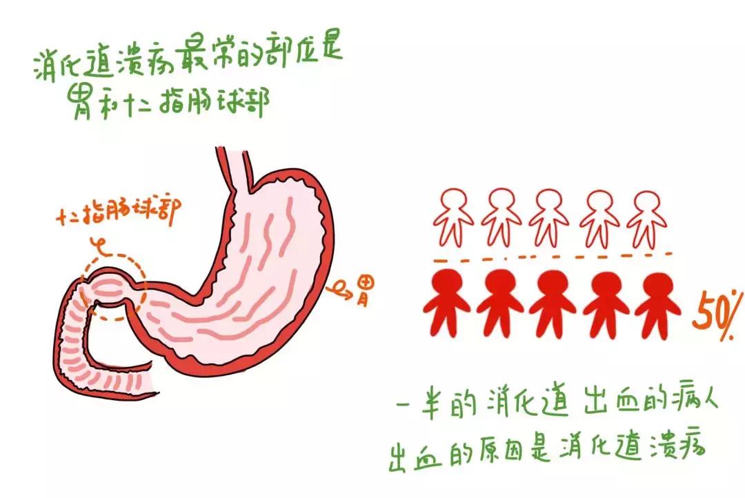 小林历险记二：胃镜大揭秘