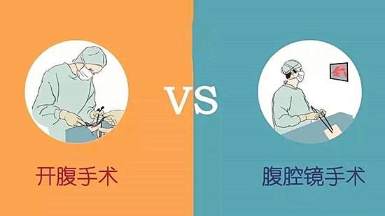 卵巢囊肿有几种手术方案,卵巢囊肿怎么动手术