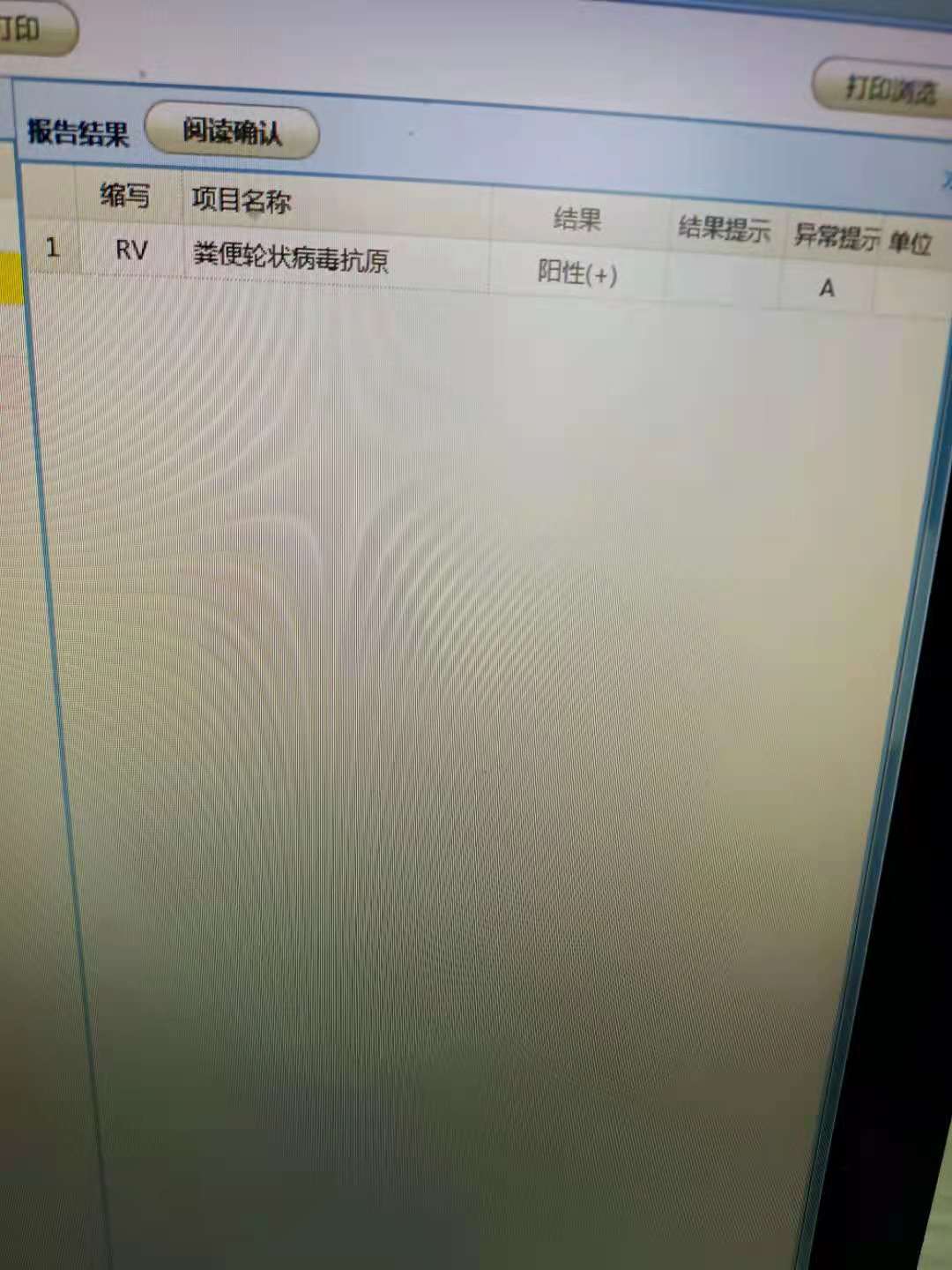 婴儿轮状病毒感染7天没好,婴儿感染轮状病毒腹泻几天能好