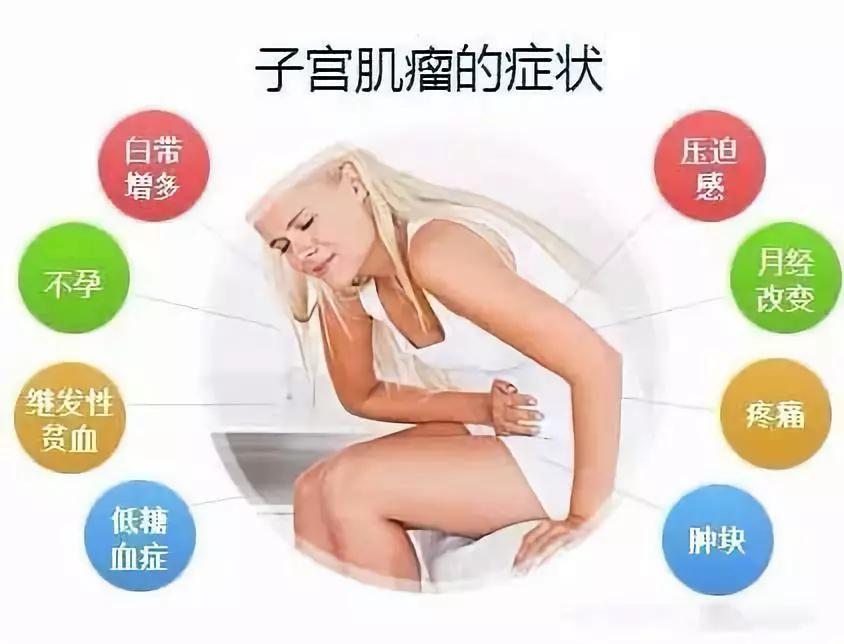 专家讲治疗子宫肌瘤的方法,微创介入子宫肌瘤栓塞术