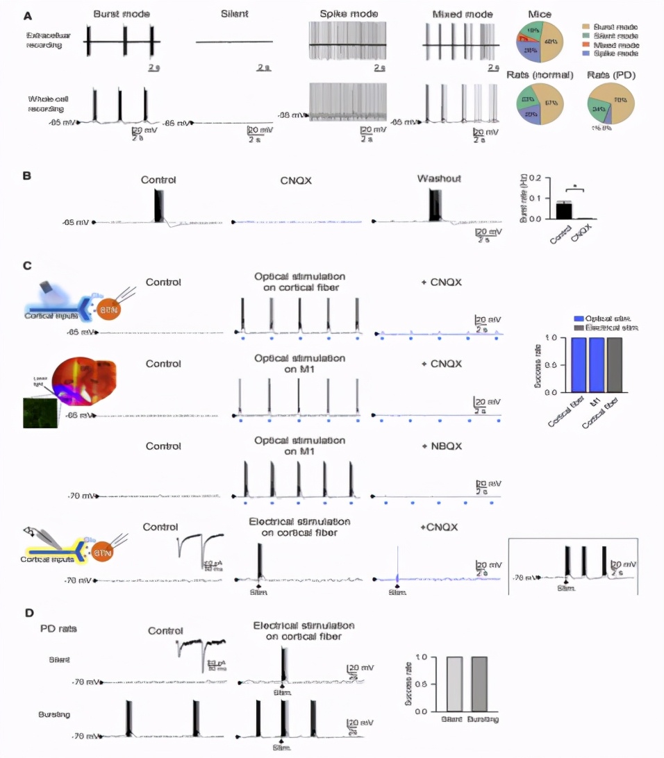 帕金森患者典型的震颤,帕金森病震颤的神经环路机制