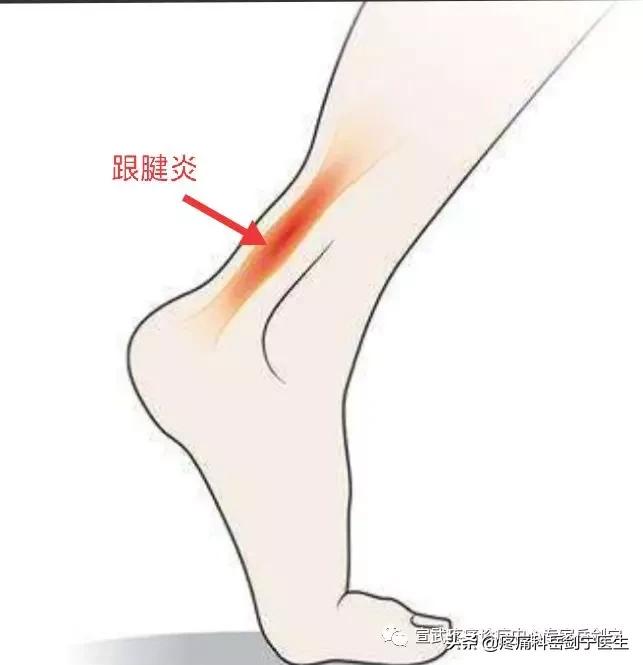 行万里路脚疼怎么办,行万里路方知世间疾苦