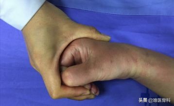 干货！骨折术后患者如何进行居家康复训练？