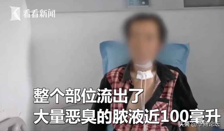 每日最陕西｜西安一男子颈部被医生抽出百余毫升腐臭脓液，致病原因竟如此常见！你平时注意过吗？