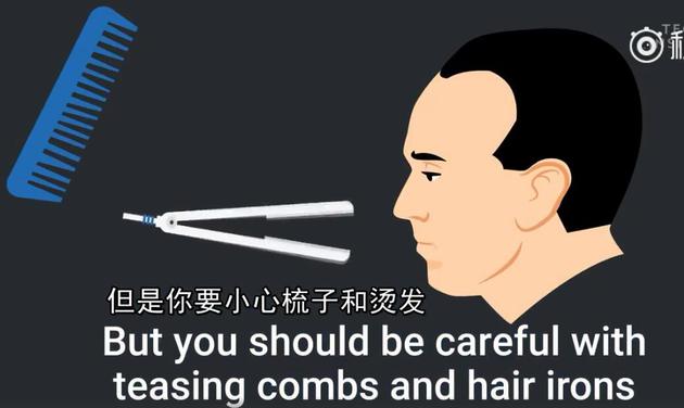 小贝上央视新闻,小贝秃头照