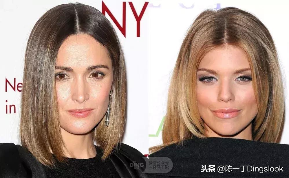 颧骨很凸太阳穴凹陷怎么改善,太阳穴凹陷颧骨突出怎么改善饱满