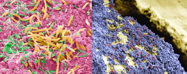牙齿发黑的原因及解决方法,牙齿变黑的原因和治疗的方法
