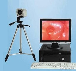 孕期查出tct高级别病变,孕妇检查tct有问题怎么办